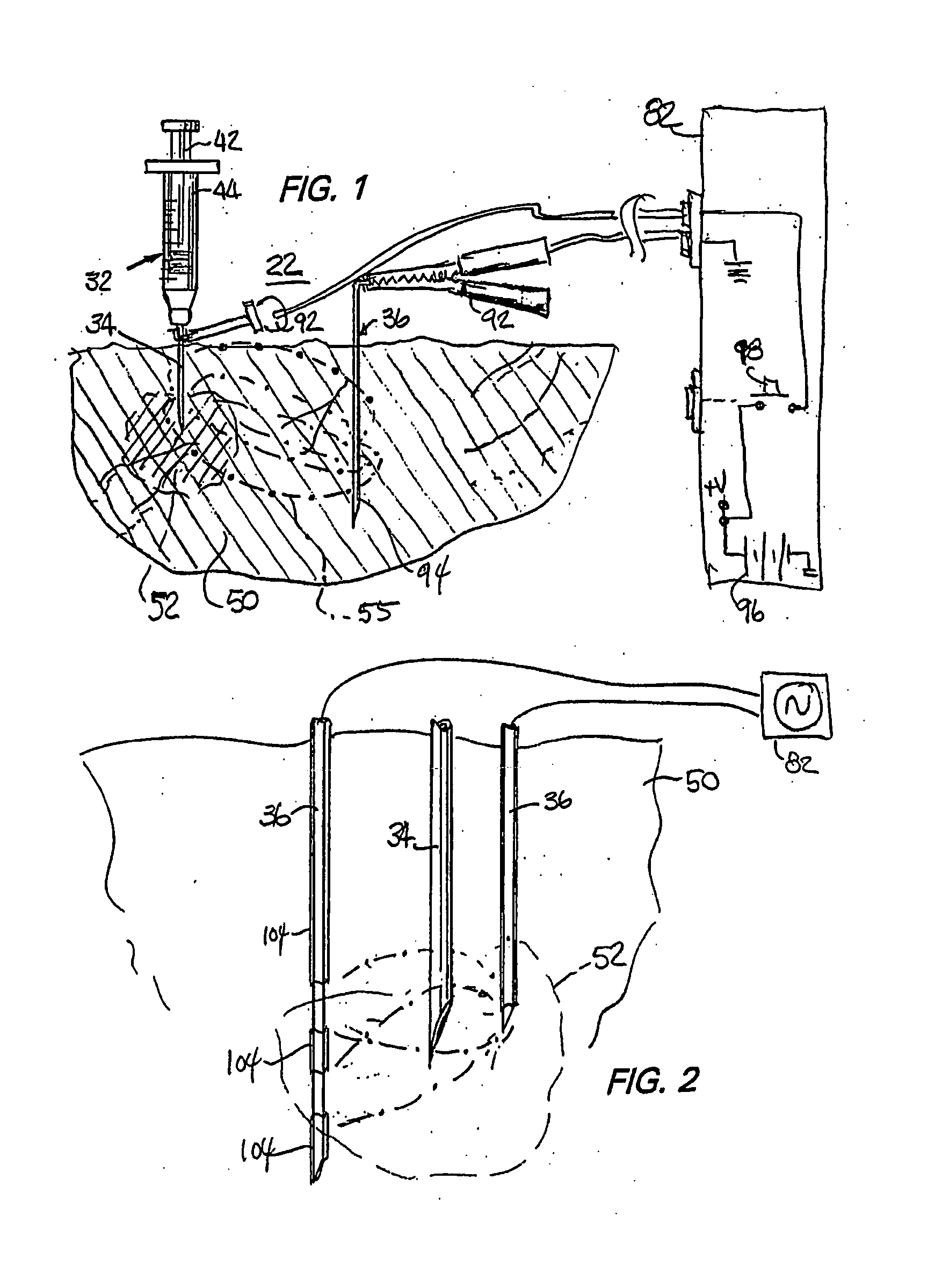 Clinical syringe with electrical stimulation aspects