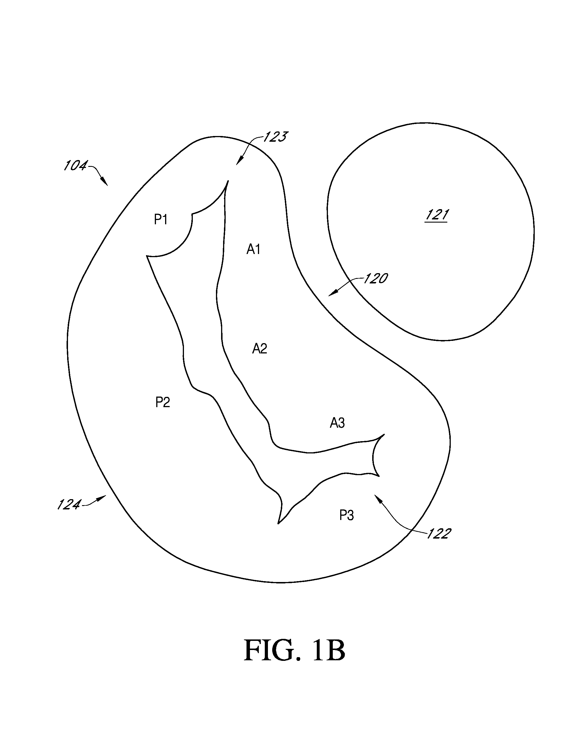Method of reconfiguring a mitral valve annulus