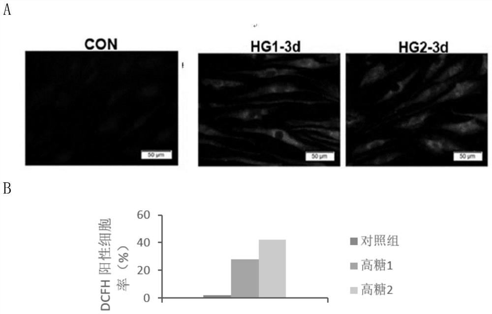 Preparation method and application of a high-concentration glucose solution-activated mesenchymal stem cell conditioned medium