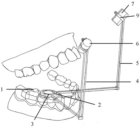 Laser-based three-dimensional positioning and guiding device for root canal therapy dental pulp opening passage