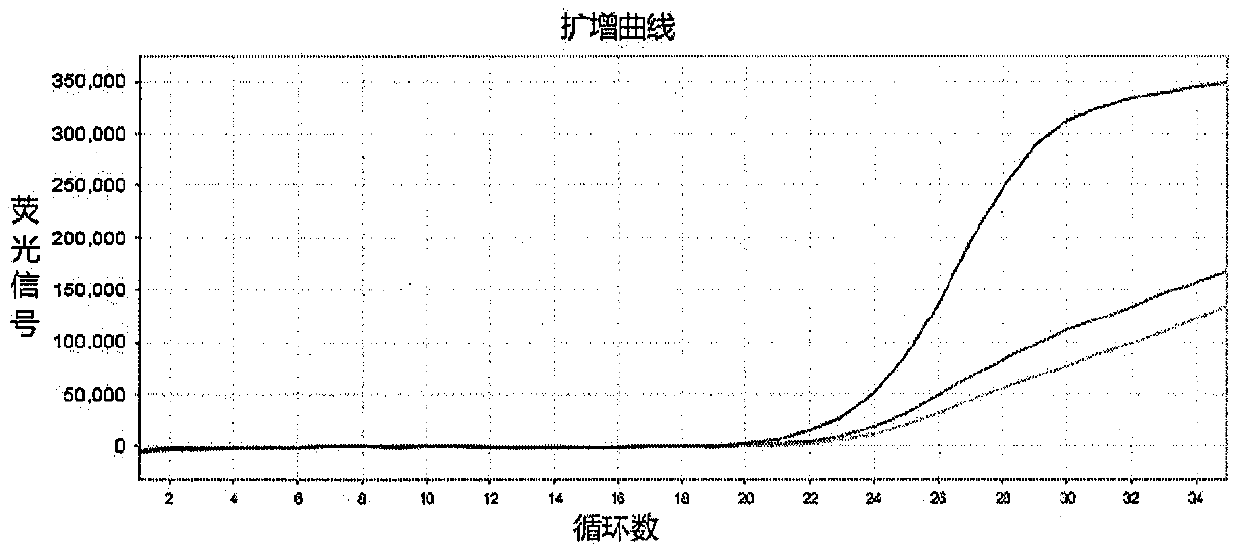 Establishment of methodology for detecting genes affecting efficacy of antihypertensive drugs by TaqMan-MGB probe technique