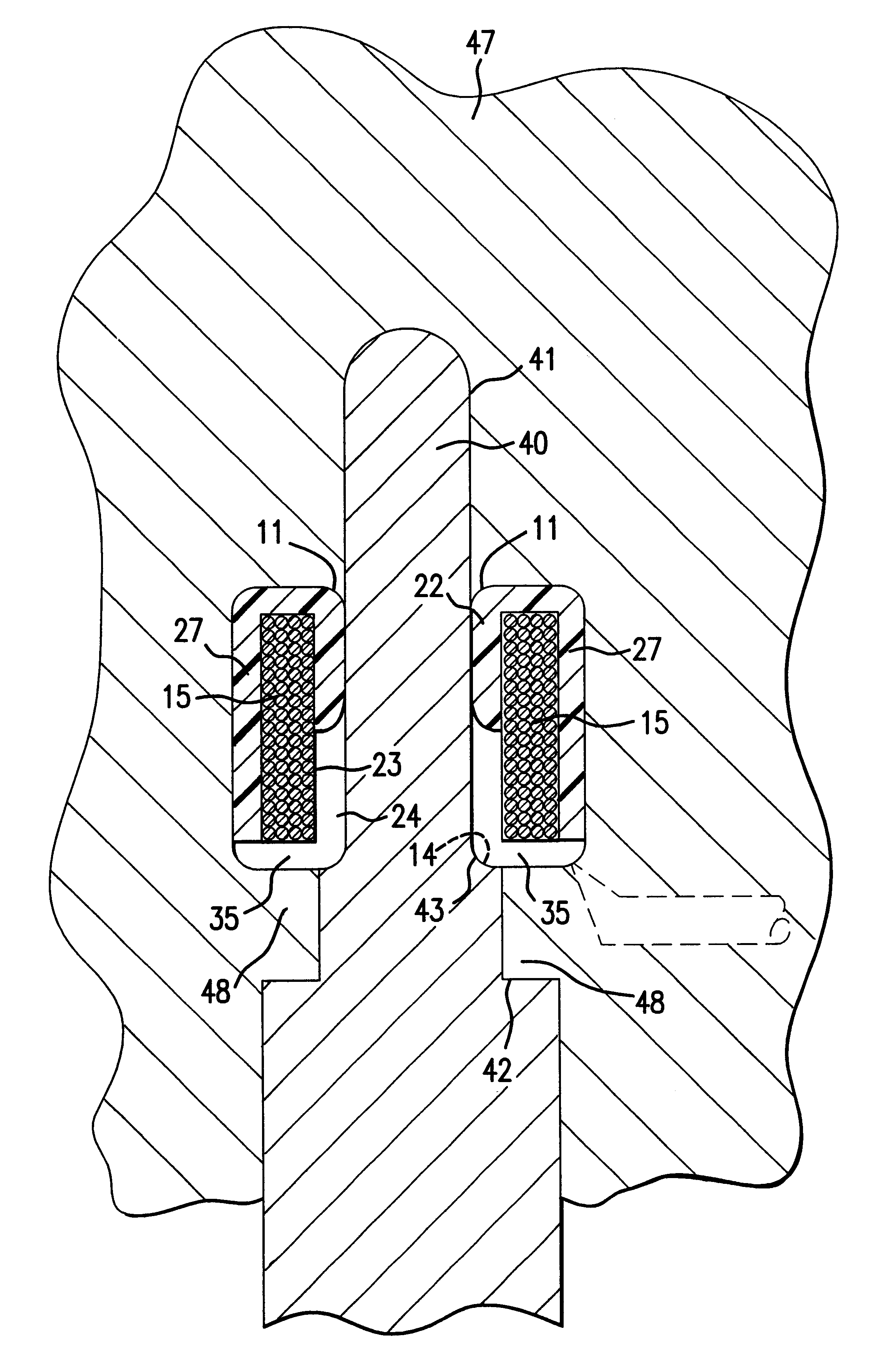 Method and apparatus for encapsulating a ring-shaped member