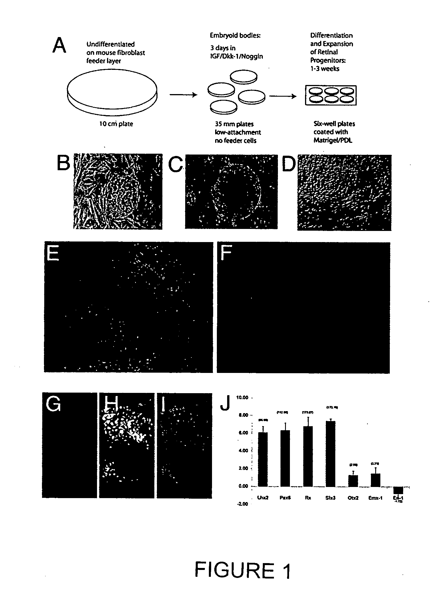 Method of generating human retinal progenitors from embryonic stem cells