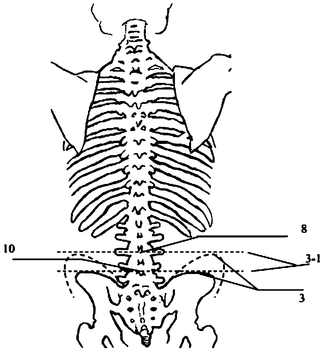 A method for positioning the spinal and lumbar intervertebral space