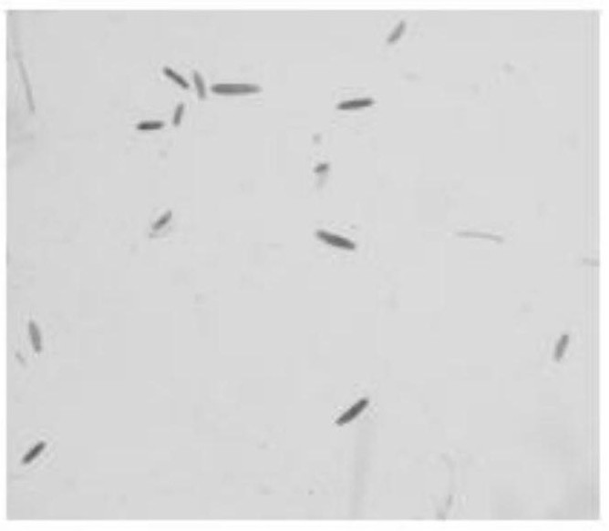Culture method for rapid and mass production of spores from pathogenic bacteria of sugarcane stripe