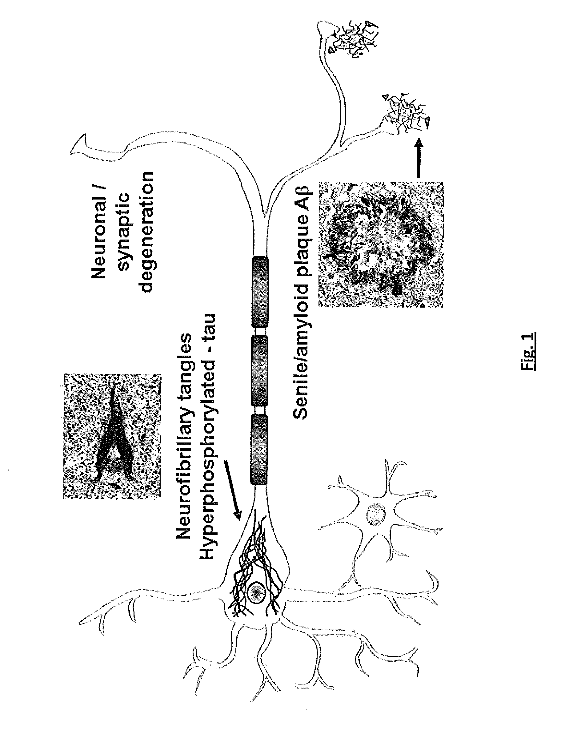 Effective Amounts of (3aR)-1,3a,8-Trimethyl-1,2,3,3a,8,8a-hexahydropyrrolo[2,3 b]indol-5-yl Phenylcarbamate and Methods of Treating or Preventing Neurodegeneration