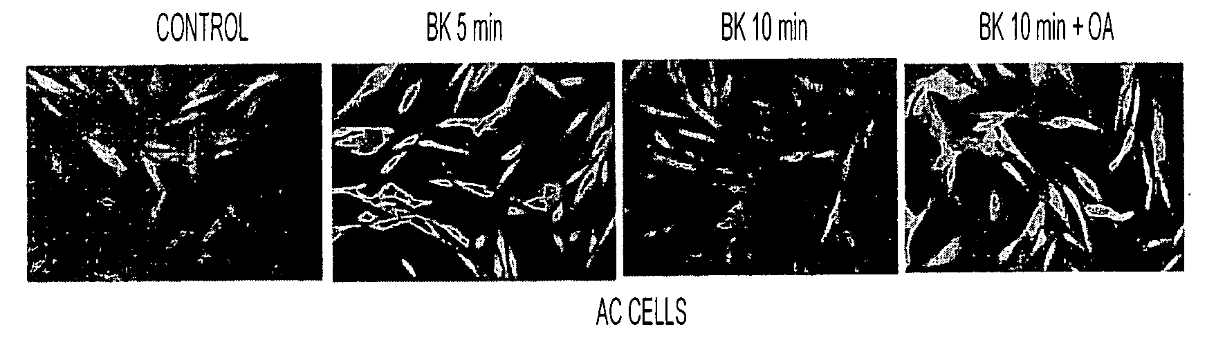 Abnormalities of Phosphatase 2A (PP2A) for Diagnosis and Treatment of Alzheimer's Disease