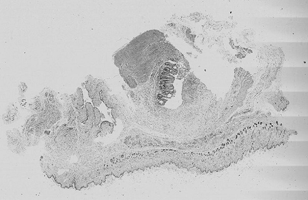 Construction method of infectious anal fistula animal model