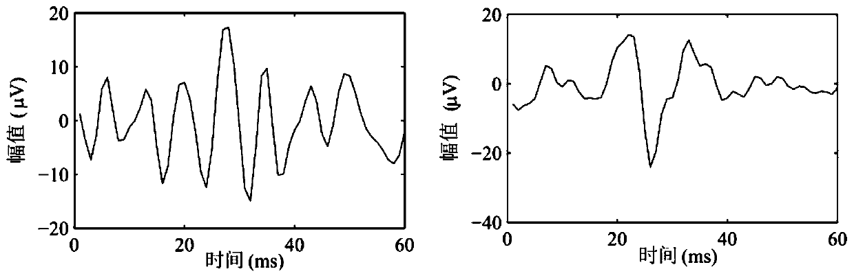 Time-frequency-analysis-based method for automatically separating peak activities in high-frequency oscillation rhythms