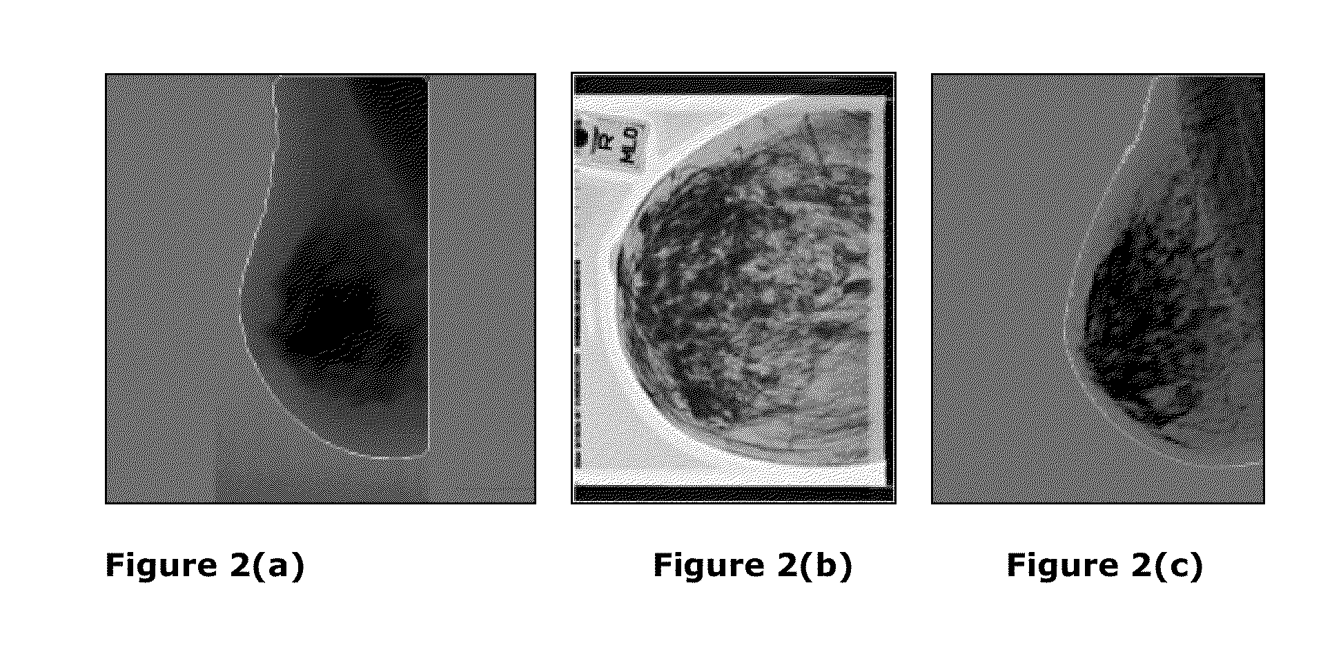 Method and system to detect the microcalcifications in X-ray images using nonlinear energy operator