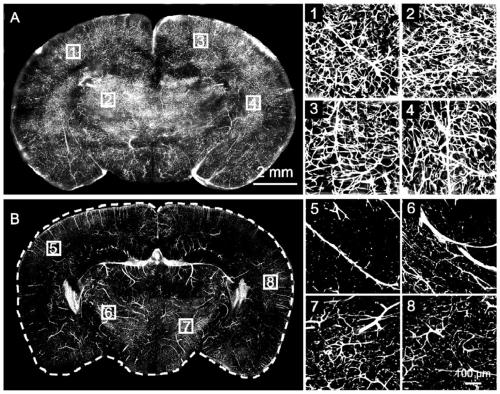 A composite nanoparticle for three-dimensional fluorescence imaging of vascular network, its preparation method and application
