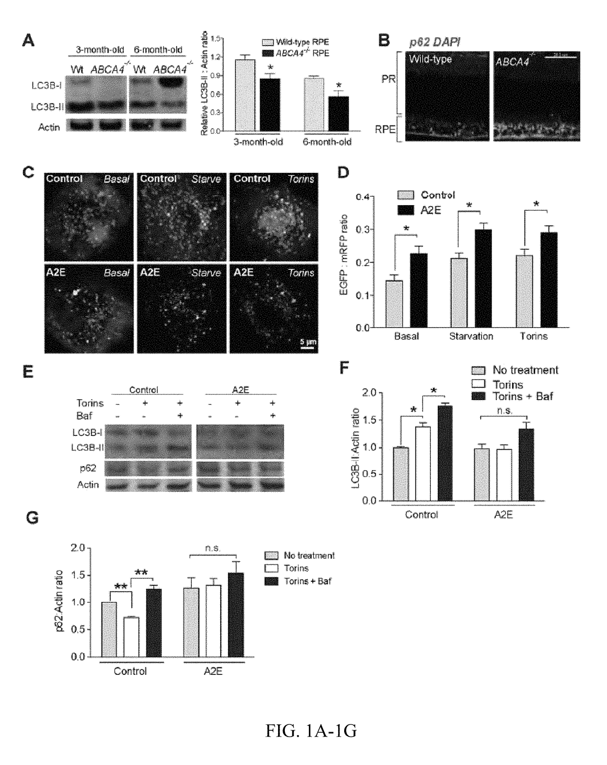 Use of inhibitors of acid sphingomyelinase to treat acquired and inherited retinal degenerations