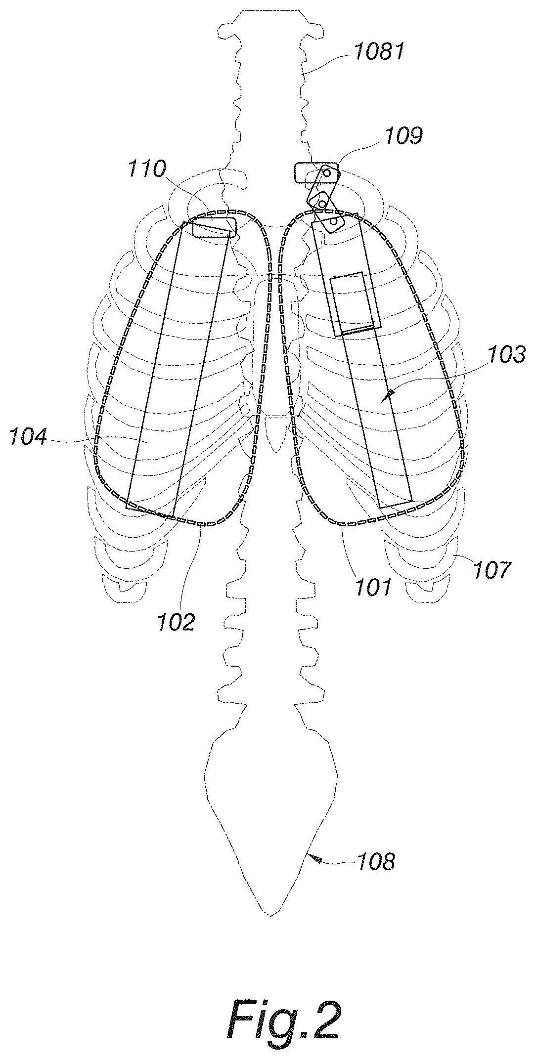 Respiratory gating phantom device