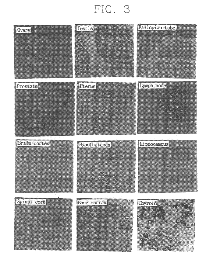 Cell growth inhibiting and cell differentiation specific SYG972 gene, genomic DNA and promoter thereof