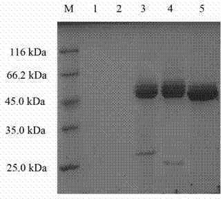 Recombined pichia pastoris strain for commonly expressing glucamylase and alpha-amylase and construction method thereof as well as mixed enzyme preparation