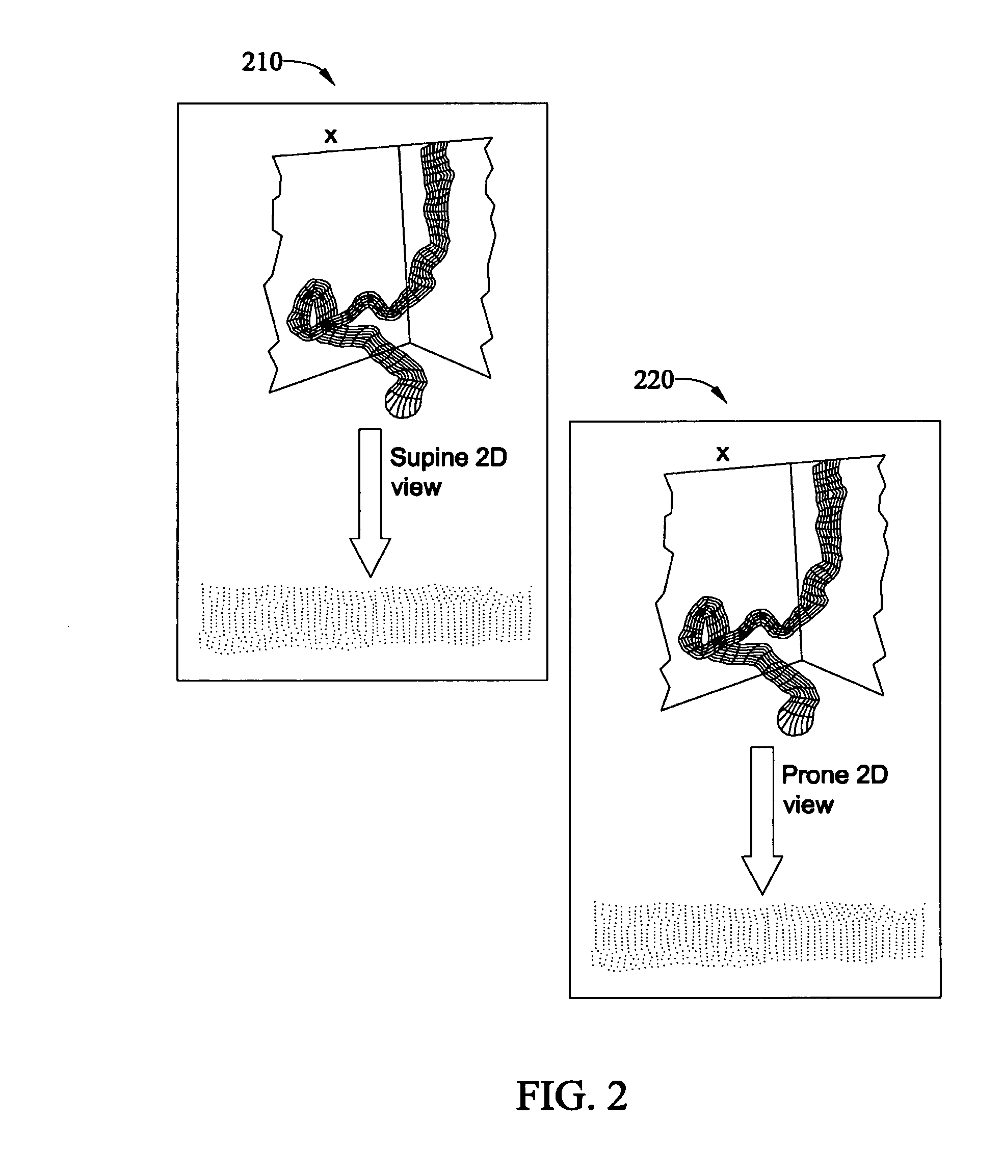 Method and apparatus for synchronizing corresponding landmarks among a plurality of images