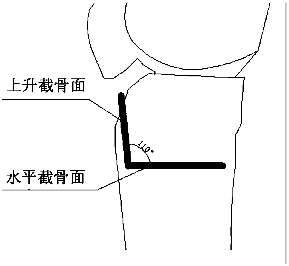 Open-type wedge osteotomy device