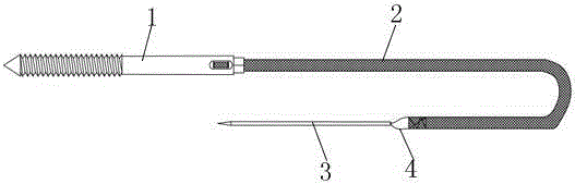 Integrated fixing device for olecranal fracture