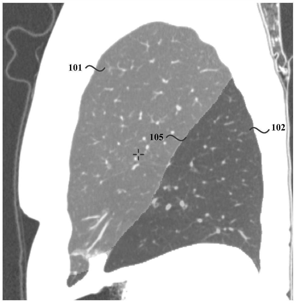 A lung lobe segmentation method, device, computer equipment and storage medium