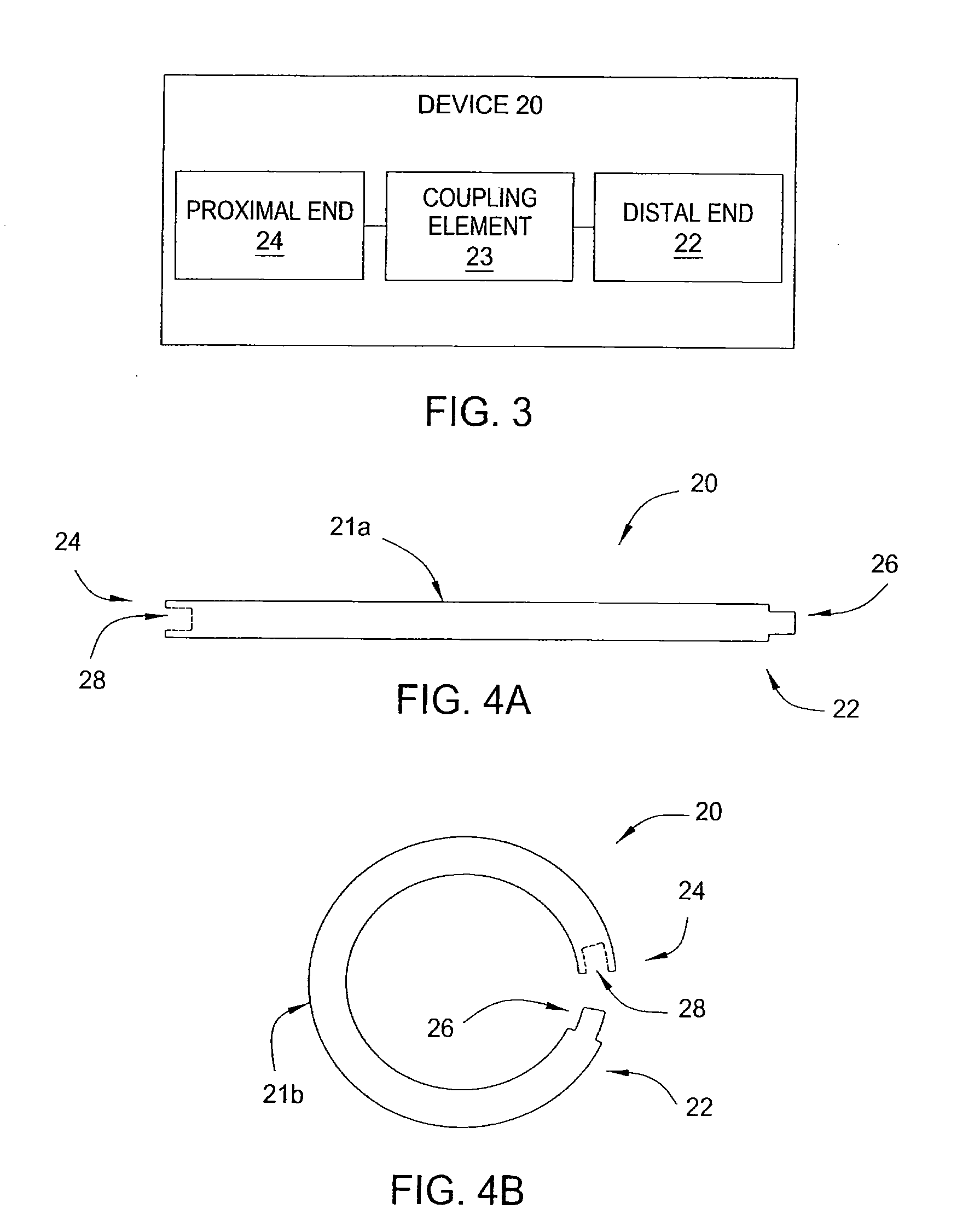 Apparatus and methods for minimally invasive obesity treatment