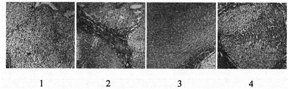 Pharmaceutical composition for preventing liver cirrhosis and application thereof