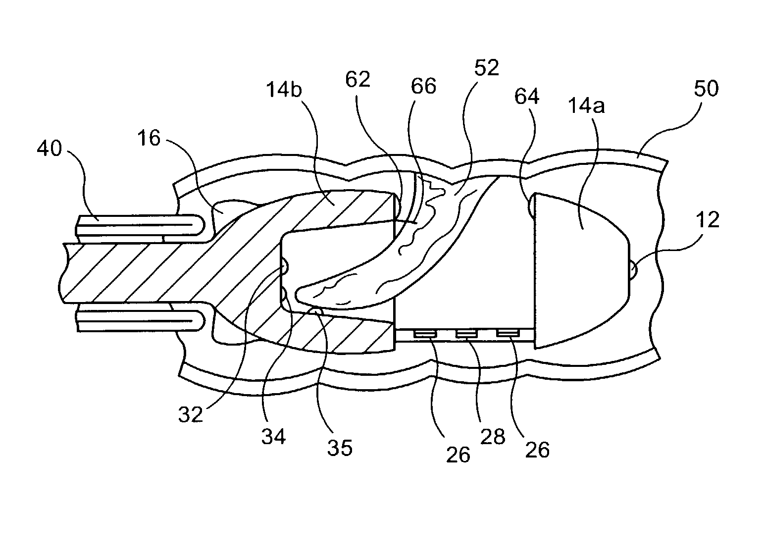 Full thickness resection device