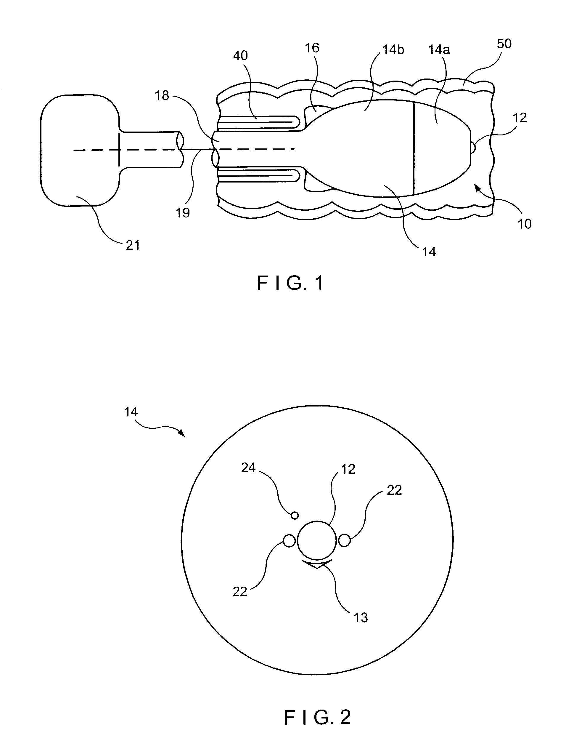 Full thickness resection device