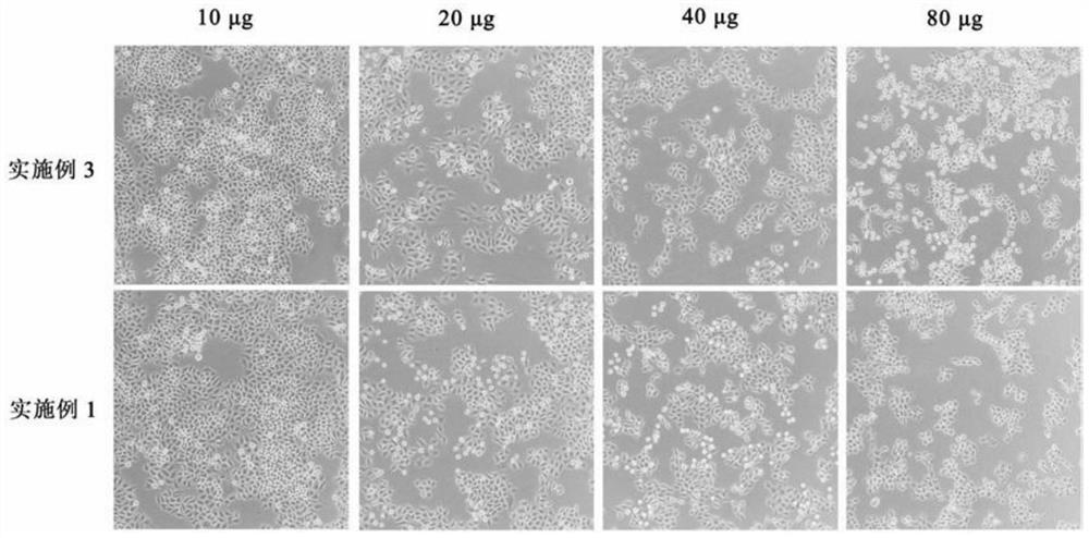 Active polysaccharide protein of Morchella, Polygonatum and Snowdrop, and preparation method and application thereof