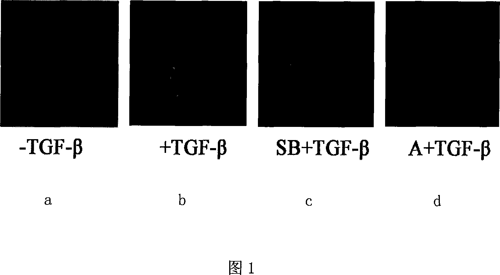 Screening model of medicaments related to TGF-Beta signal path