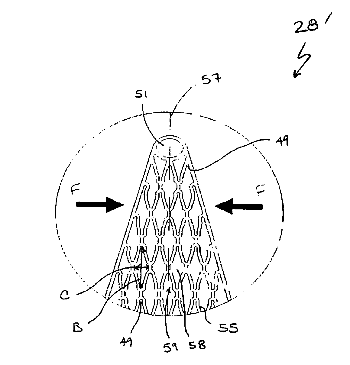 Vascular Prosthesis and Methods of Use