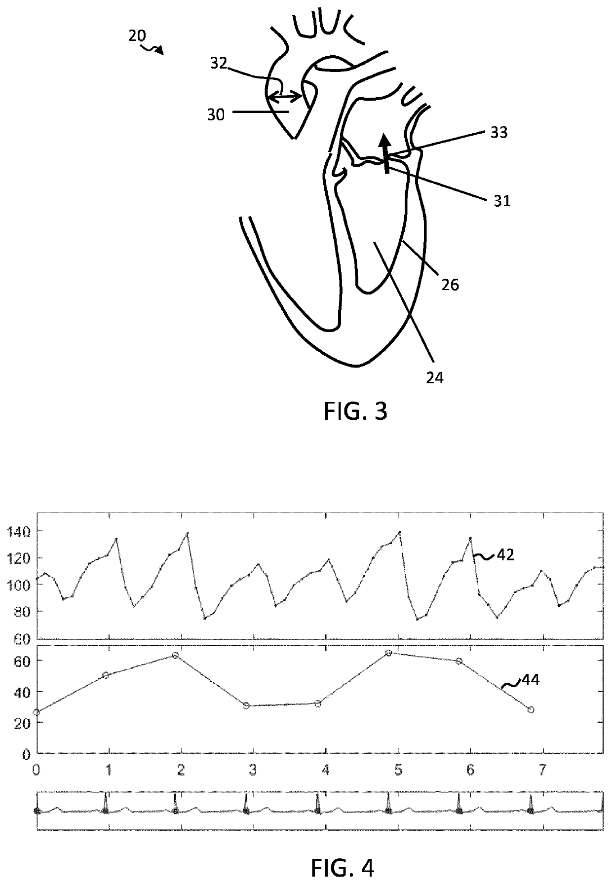 Ultrasound imaging system and method