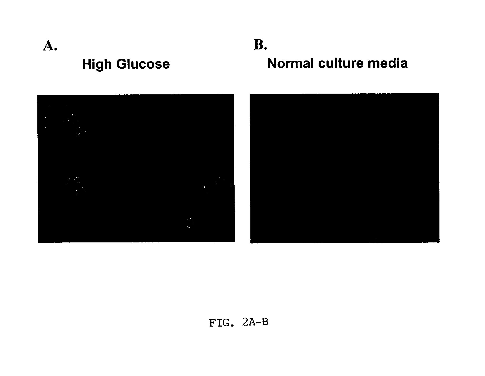 Methods and Compositions For Preparing Pancreatic Insulin Secreting Cells