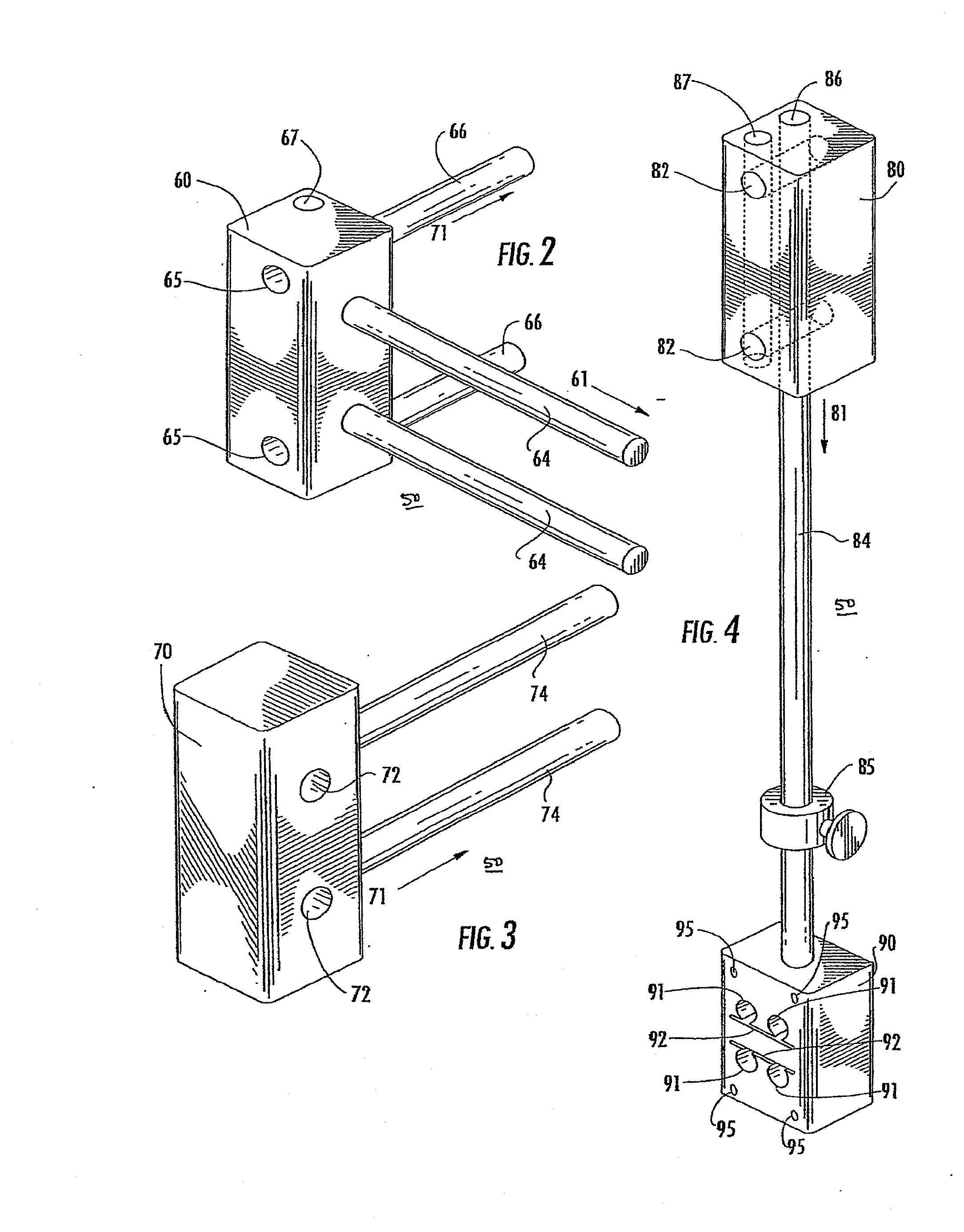 Method of Preparing an Ankle Joint for Replacement, Joint Prosthesis, and Cutting Alignmnet Apparatus for Use in Performing an Arthroplasty Procedure