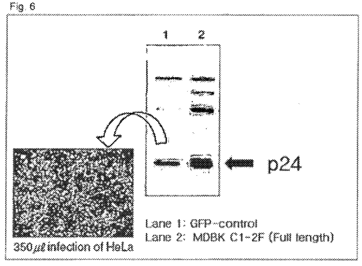 Method of preparing cells susceptible to transmissible spongiform encephalopathy and the creation of TSE persistently infected cells