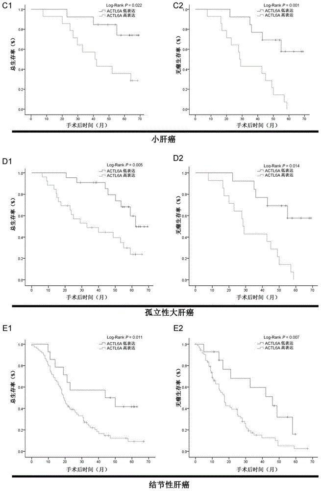 Application of ACTL6A gene to preparation of medicine for treating liver cancer or preventing relapse of liver cancer after surgery