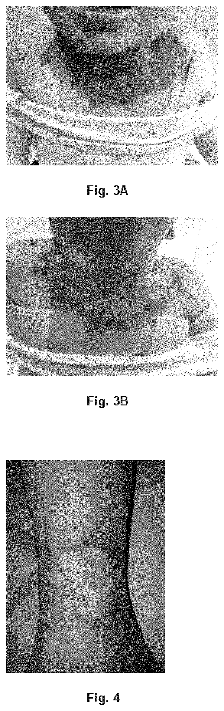 Compositions for the treatment of ischemic ulcers and stretch marks