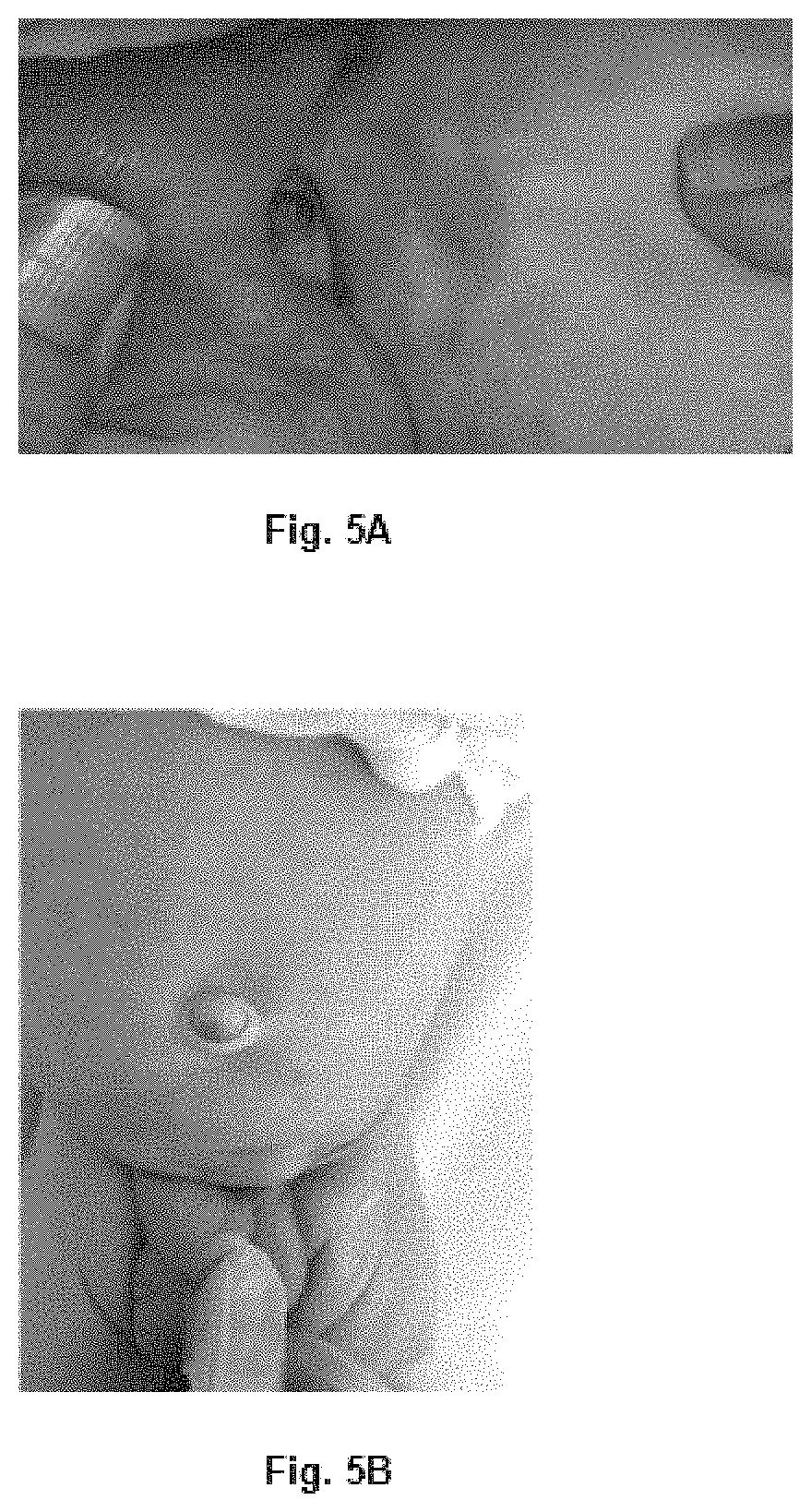 Compositions for the treatment of ischemic ulcers and stretch marks