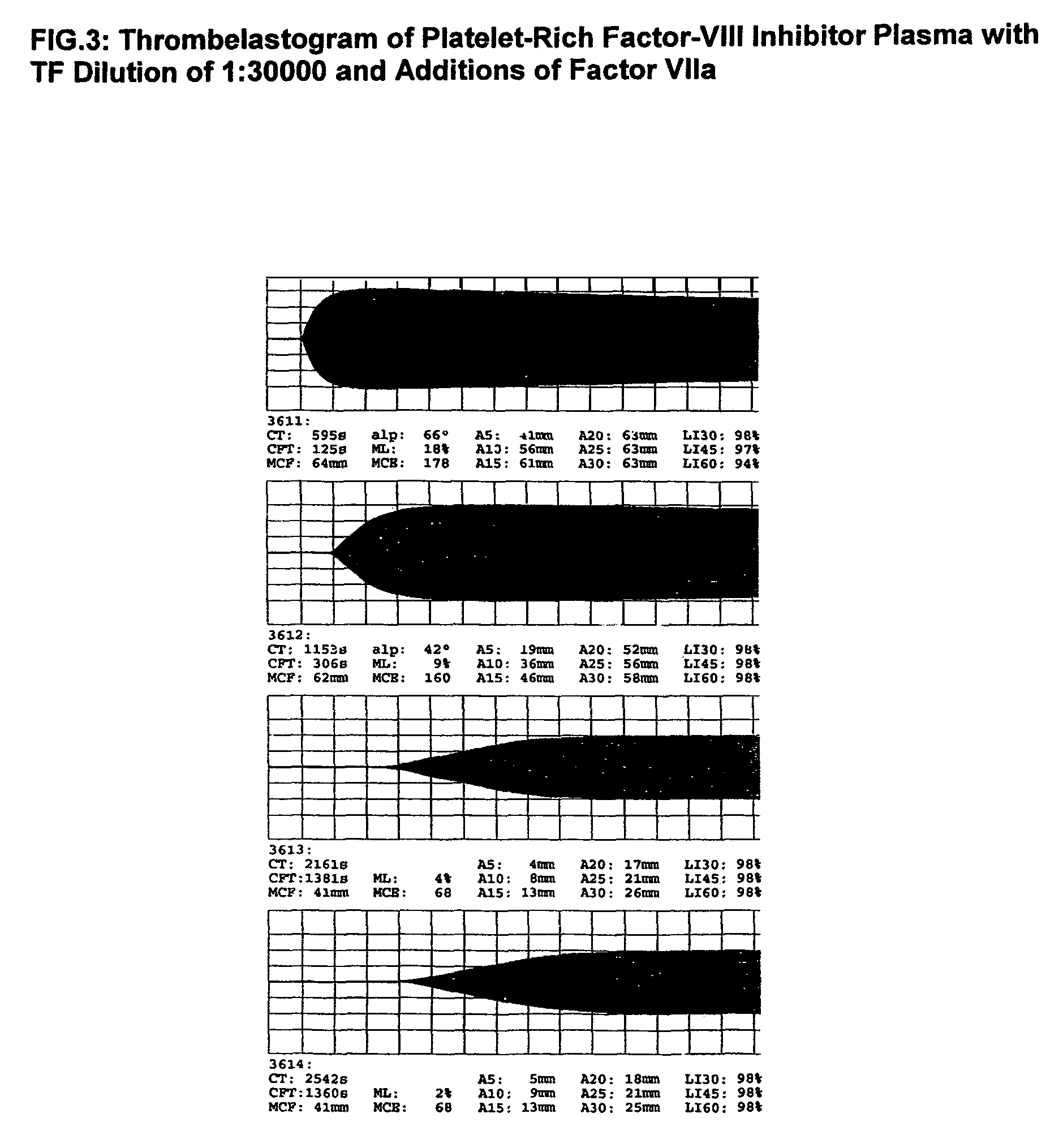 Thrombin-free composition containing freeze-dried, virally inactivated FXIa and serpins and/or kininogen