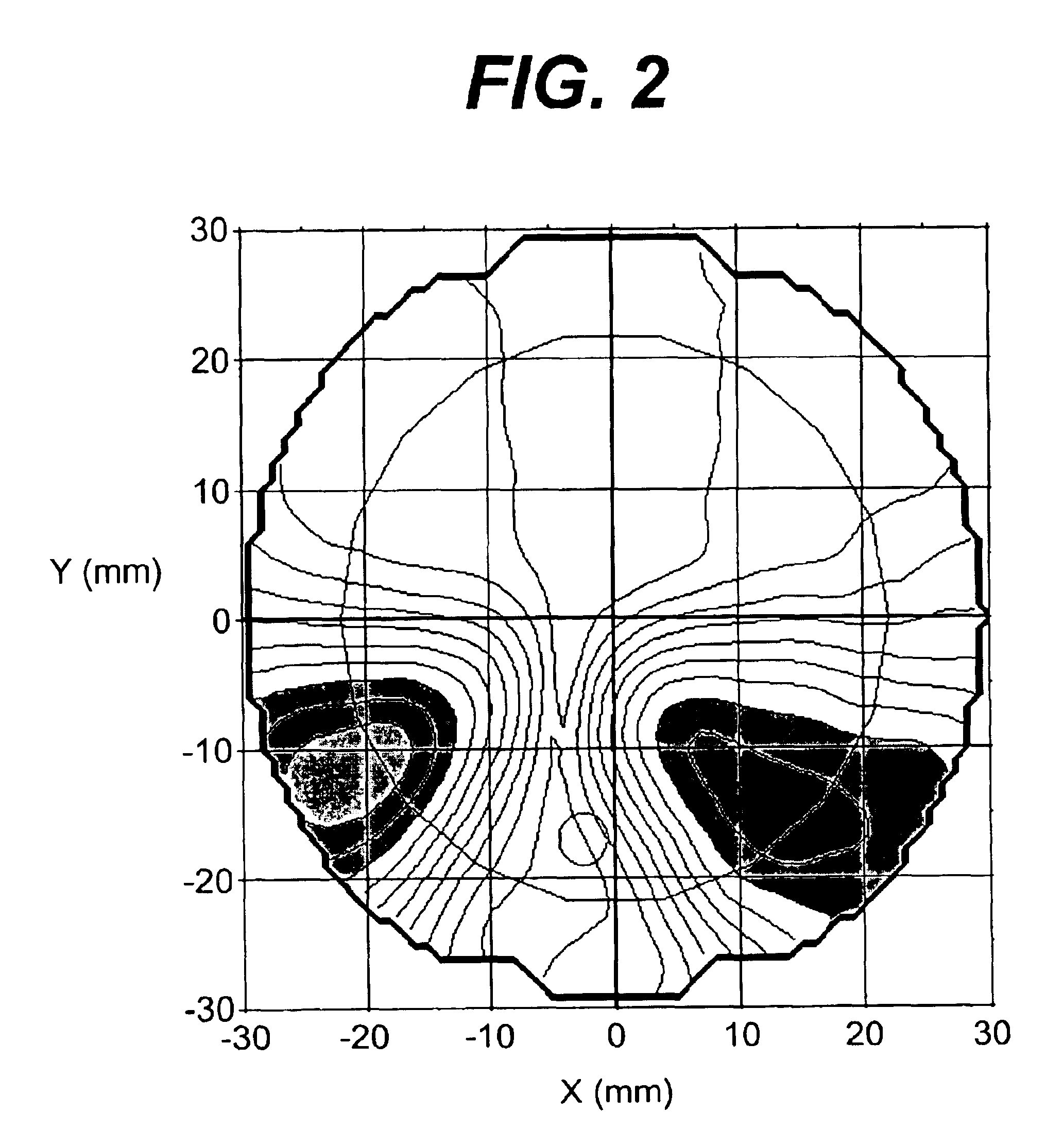 Progressive addition lenses with an additional zone