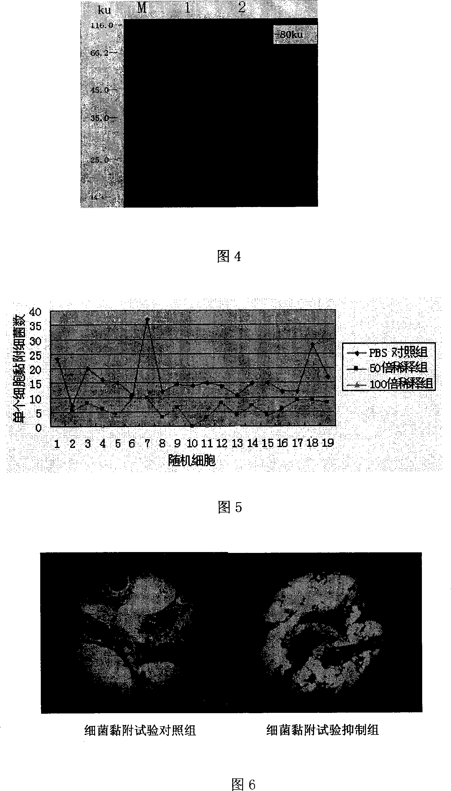 Micrococcus pyogenes adhesion functional peptide and coded sequence thereof