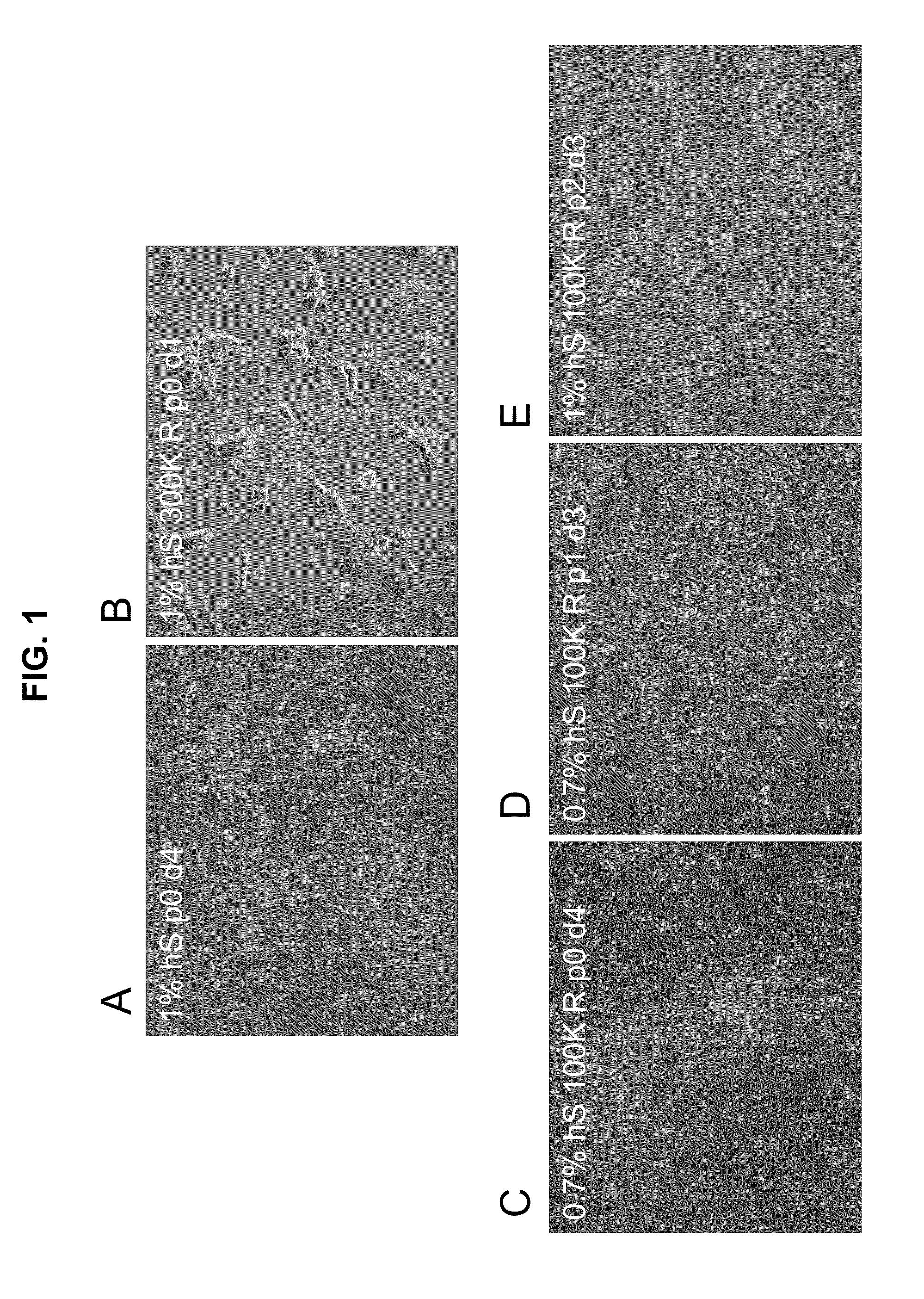 Methods and compositions for feeder-free pluripotent stem cell media containing human serum