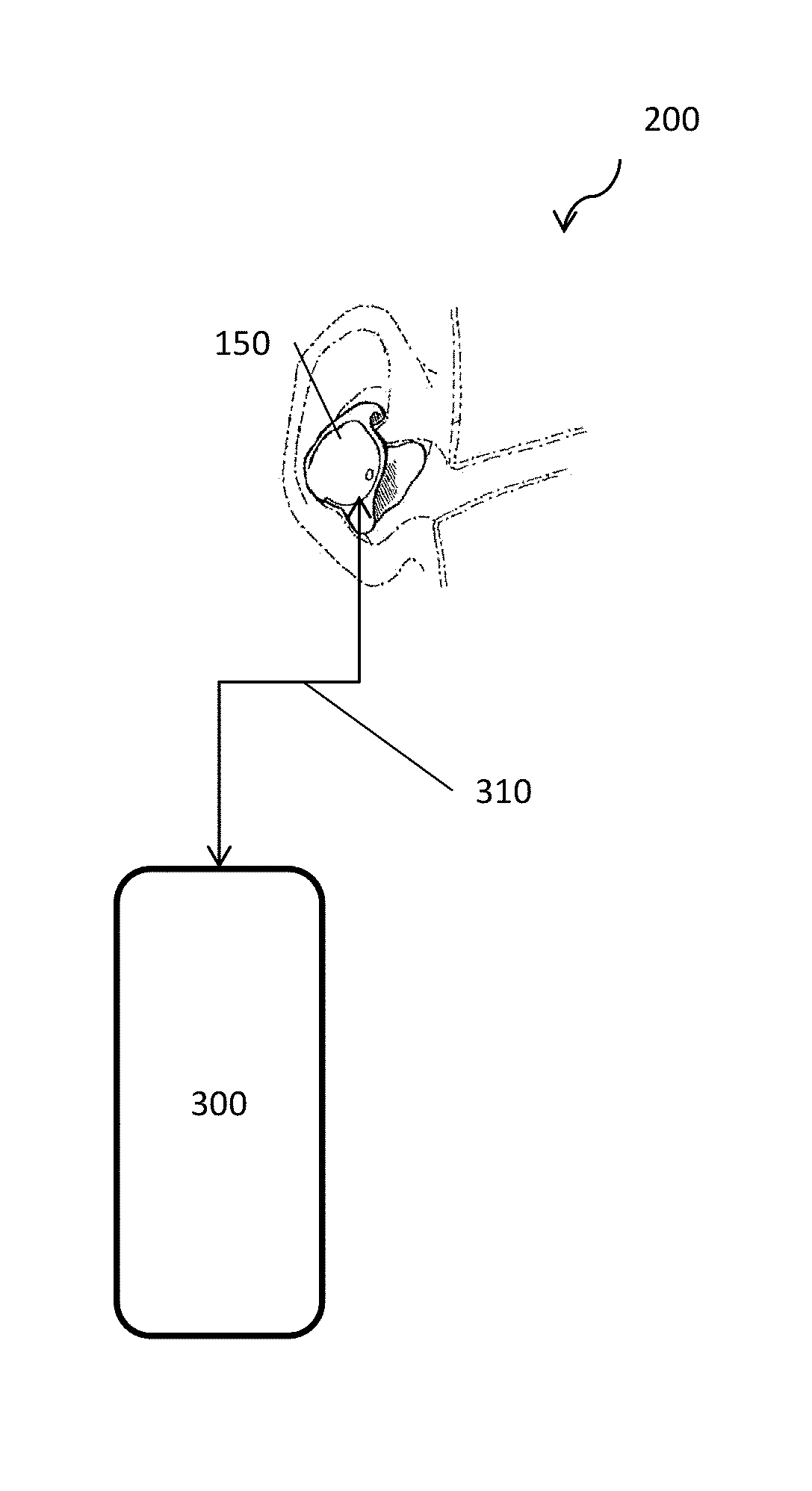 Sound system with ear device with improved fit and sound