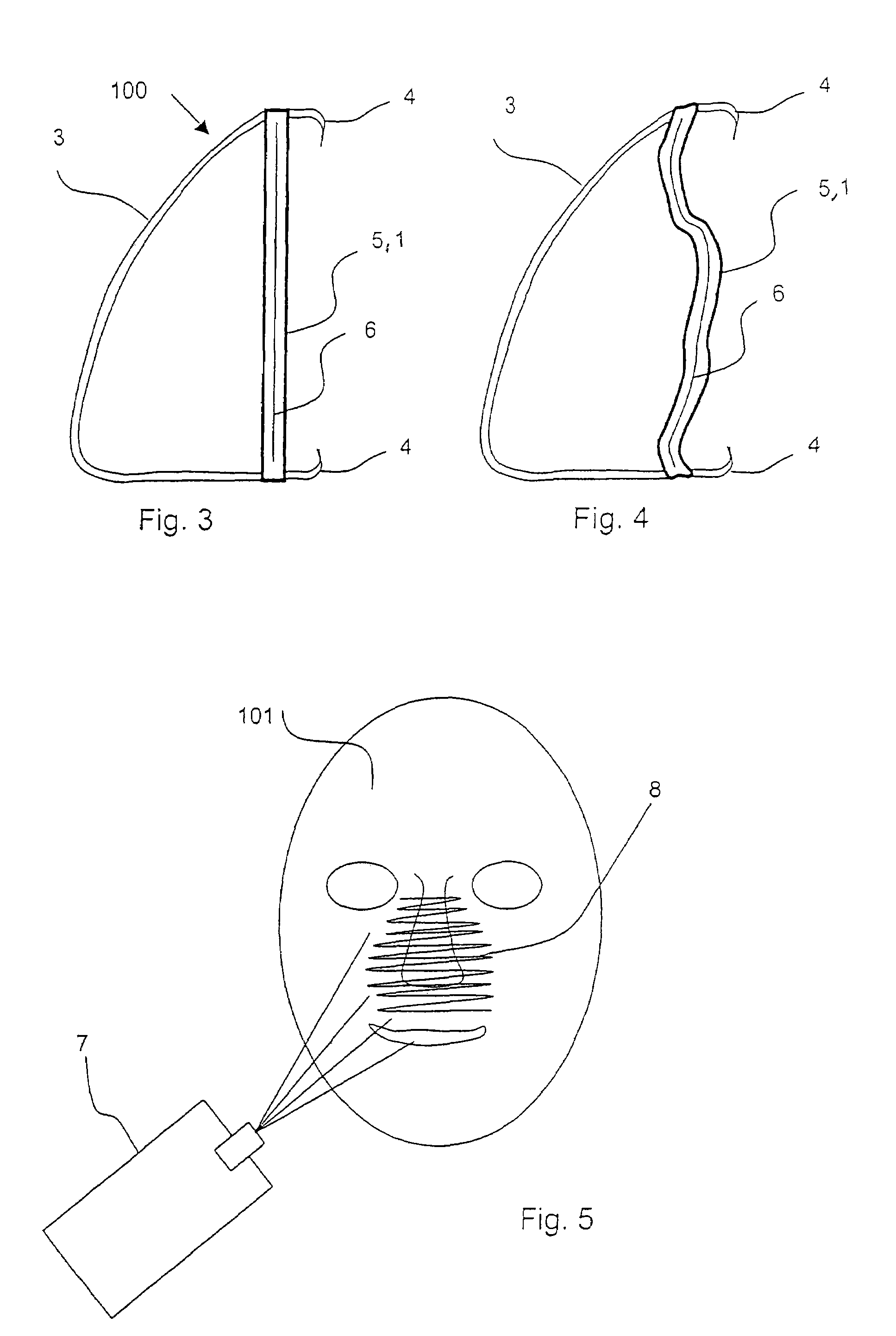 Breathing mask with individual adaptation to the shape of the face