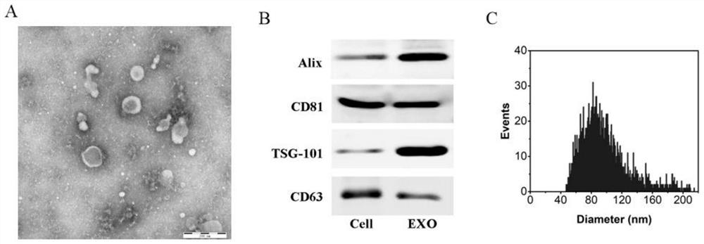 Application of exosome in preparation of drugs or cosmetics for repairing skin injury