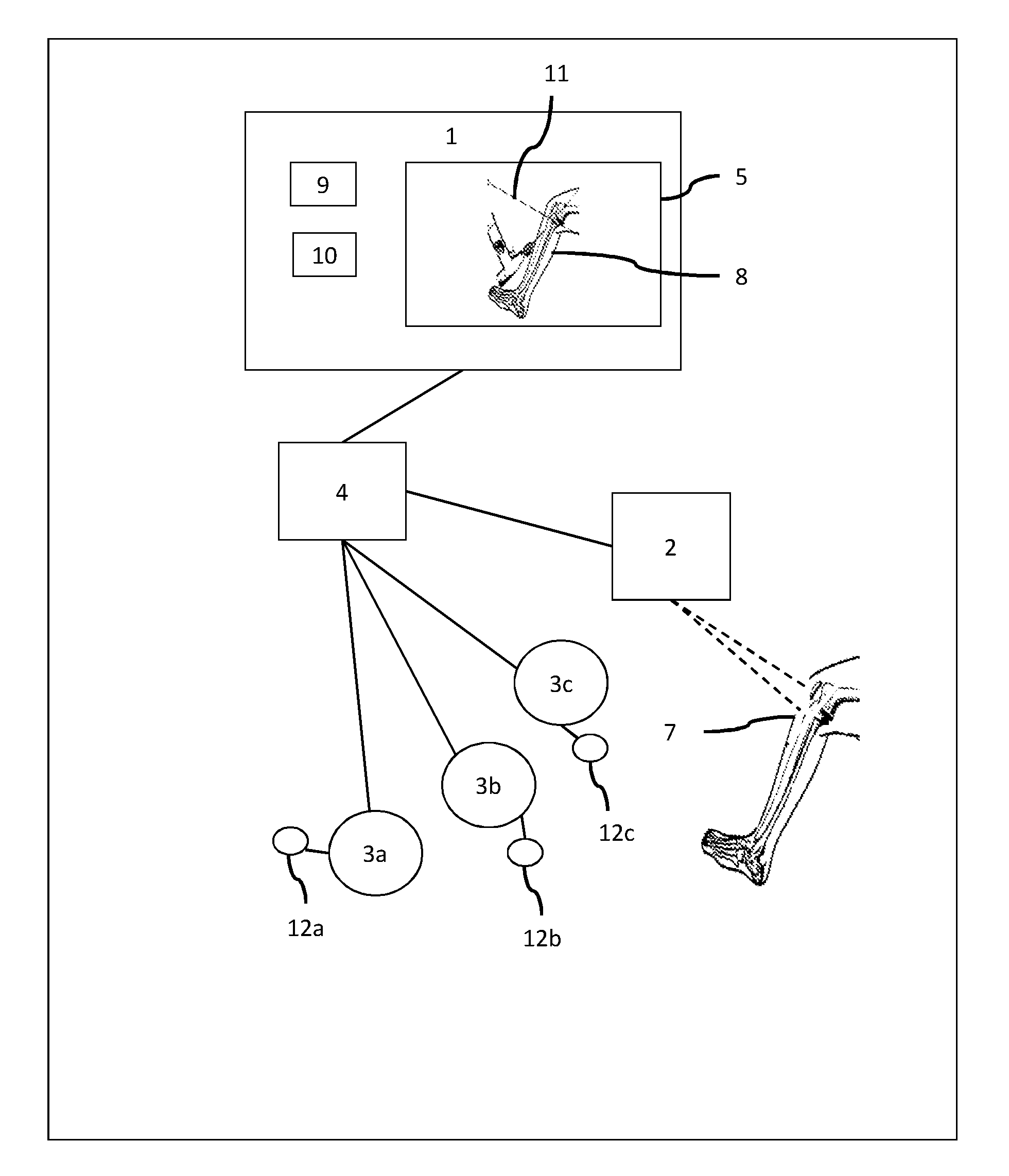 Method and System for Computer Assisted Surgery