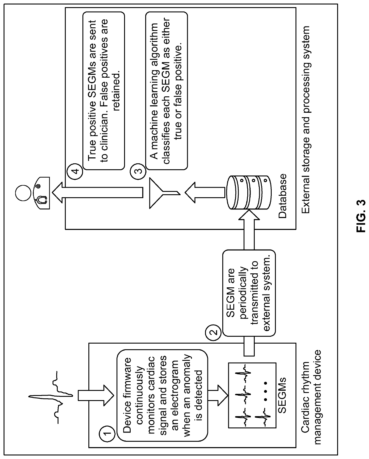 Methods and systems to confirm device classified arrhythmias utilizing machine learning models