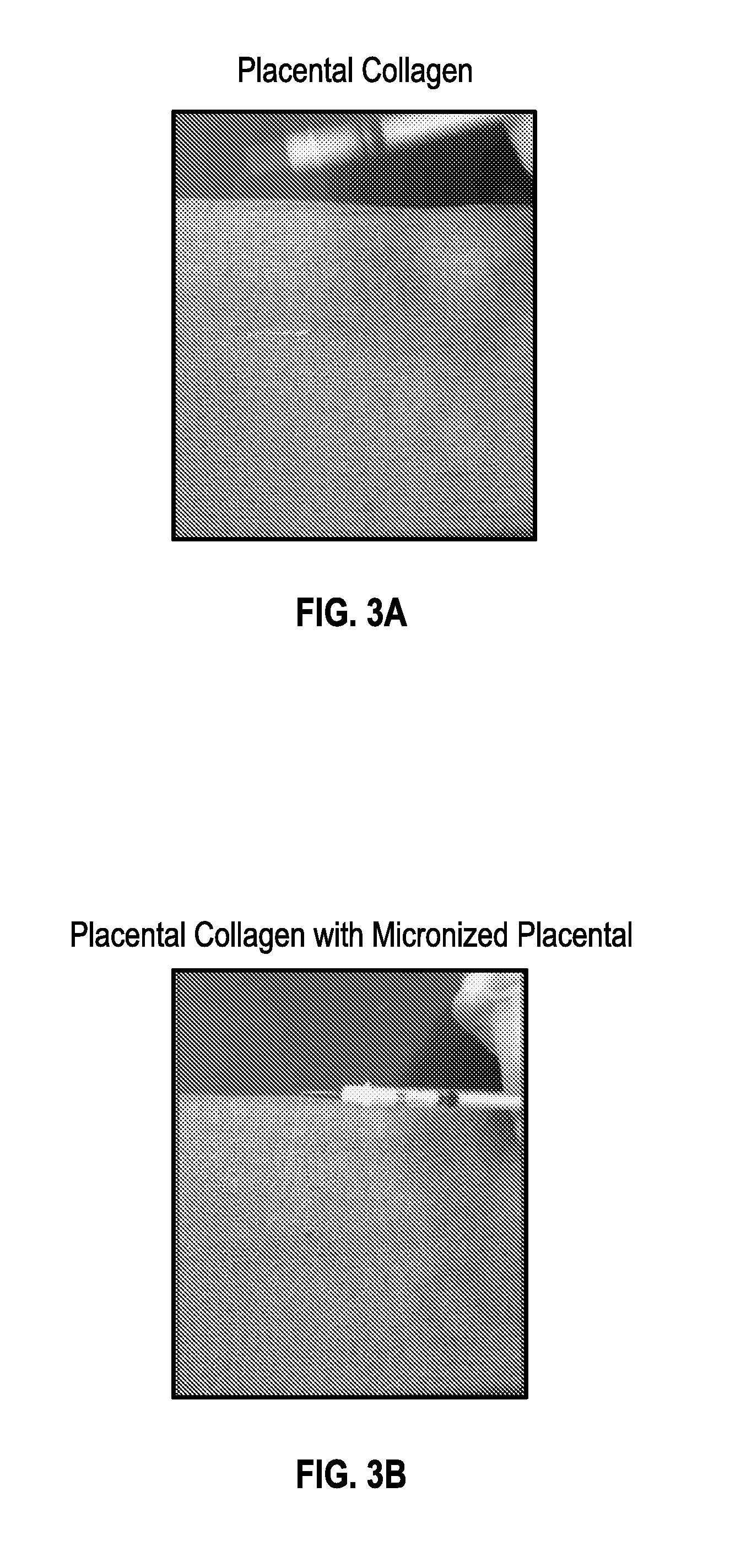 Collagen and micronized placental tissue compositions and methods of making and using the same
