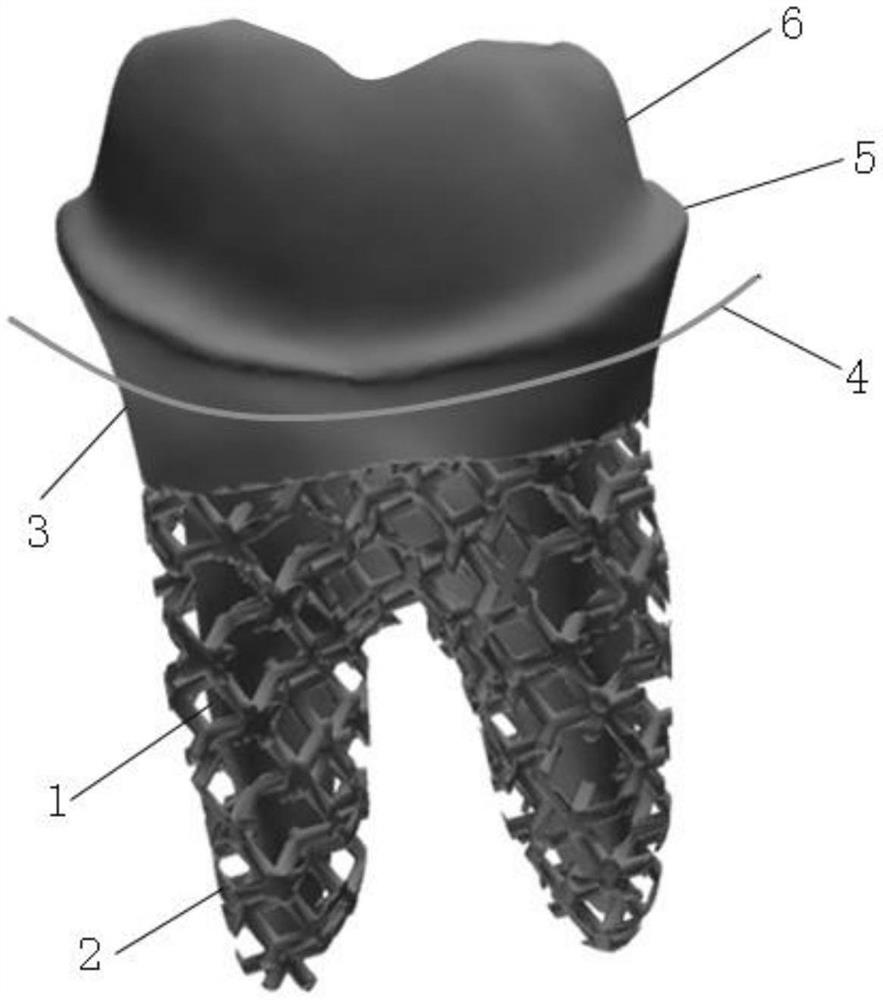 A preparation method for 3D printing porous root-shaped dental implants
