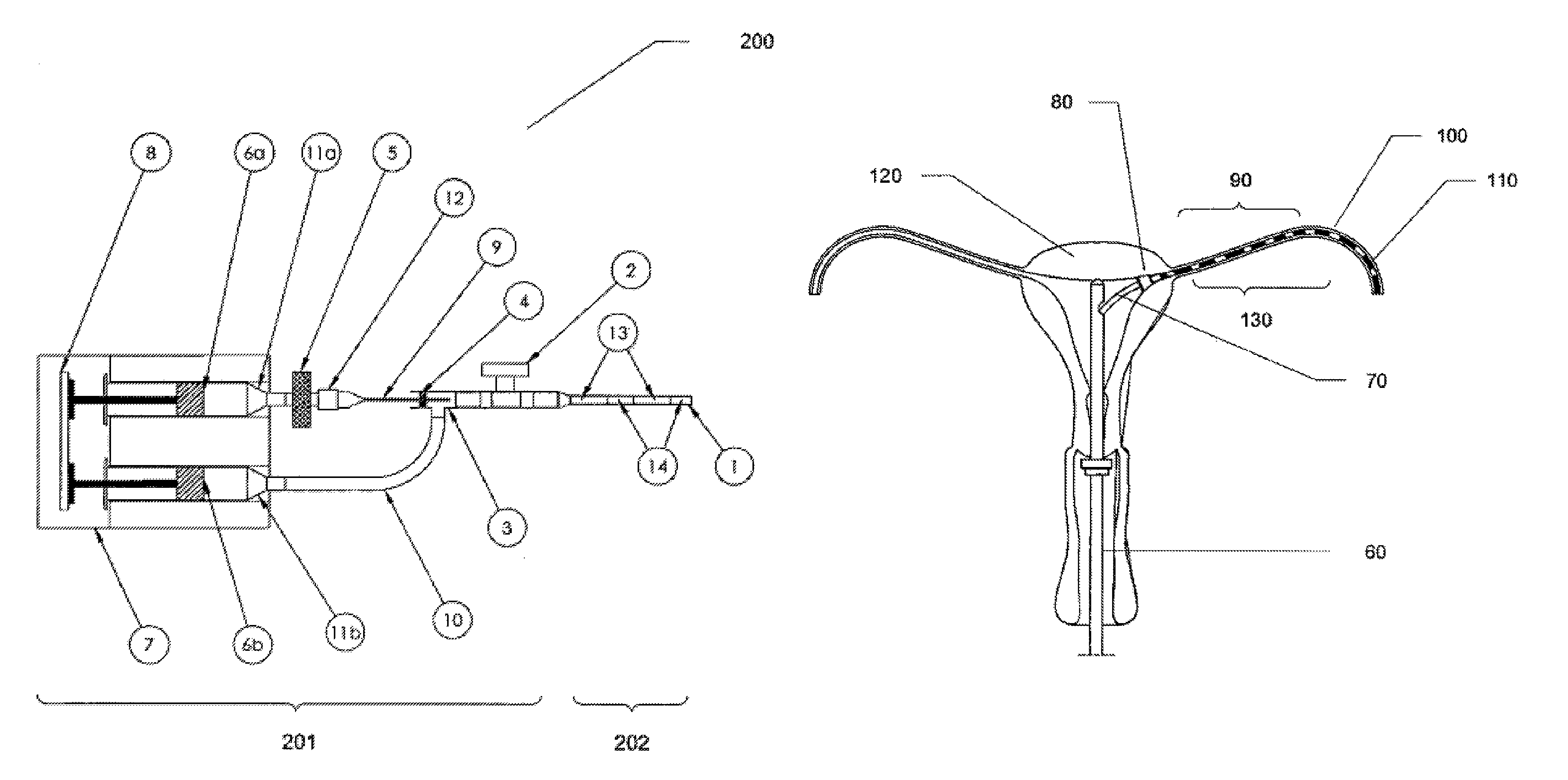 Contrast agent injection system for sonographic imaging