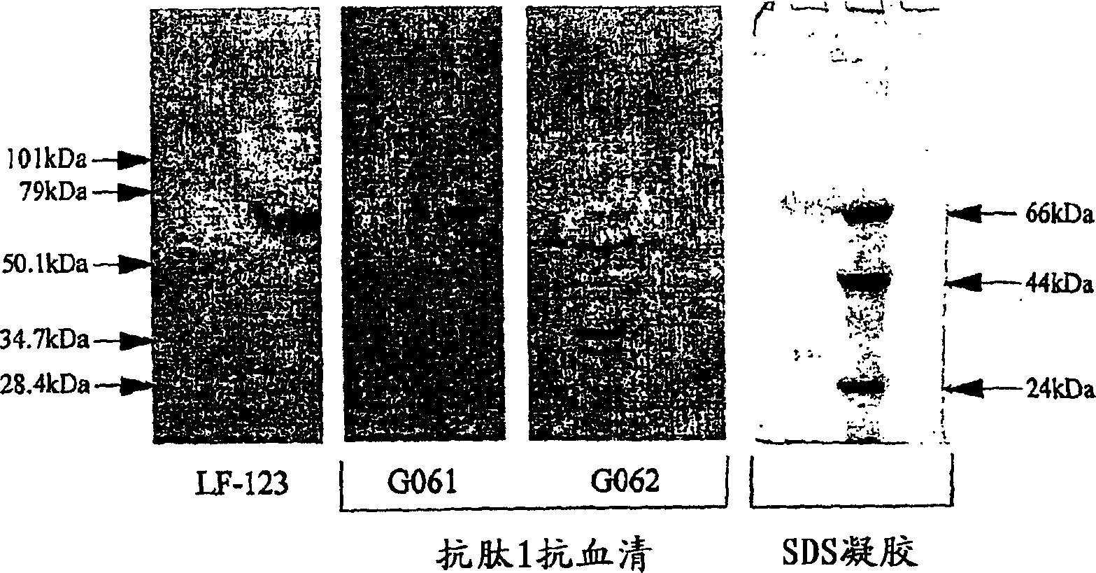 Prognostic indicator